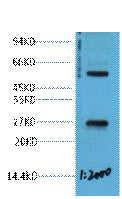 Anti-EFHD1 antibody (STJ197397) – Figure 1 of 1