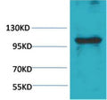 Anti-IGFN1 antibody (STJ197398) – Figure 1 of 1
