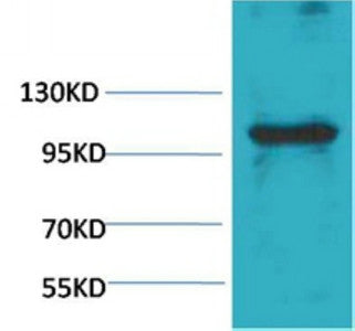 Anti-IGFN1 antibody (STJ197398) – Figure 1 of 1