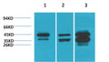 Anti-DUSP6 antibody (STJ197401) – Figure 1 of 1
