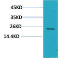 Anti-HSPB8 antibody (STJ197403) – Figure 1 of 1