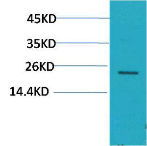 Anti-HSPB8 antibody (STJ197403) – Figure 1 of 1