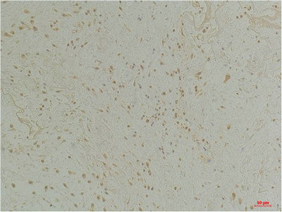 Anti-CLIC1 antibody (166-216 aa) (STJ197407) – Figure 1 of 1