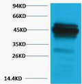 Anti-KRT18 antibody (STJ197408) – Figure 1 of 1