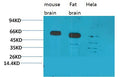 Anti-CCKBR antibody (306-356 aa) (STJ197409) – Figure 1 of 1