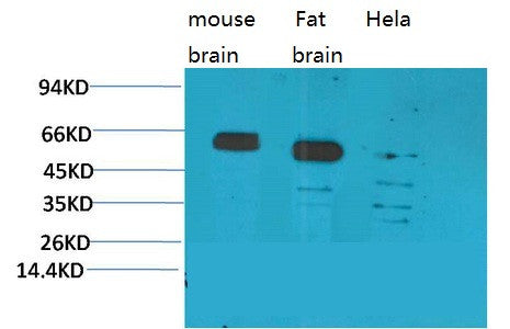 Anti-CCKBR antibody (306-356 aa) (STJ197409) – Figure 1 of 1