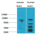 Anti-CACNA2D3 antibody (500-580 aa) (STJ197410) – Figure 1 of 1