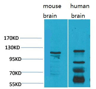 Anti-CACNA2D3 antibody (500-580 aa) (STJ197410) – Figure 1 of 1