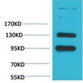 Anti-CACNA2D1 antibody (STJ197412) – Figure 1 of 1