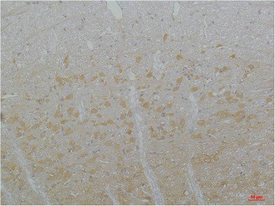 Anti-CACNA1I antibody (210-290 aa) (STJ197413) – Figure 1 of 1