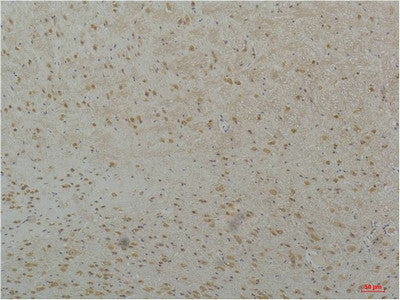 Anti-CACNA1H antibody (1718-1768 aa) (STJ197414) – Figure 1 of 1