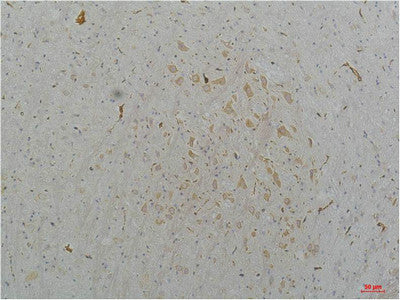 Anti-CACNA1B antibody (230-310 aa) (STJ197415) – Figure 1 of 1