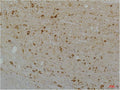 Anti-CACNA1D antibody (1060-1140 aa) (STJ197416) – Figure 1 of 1