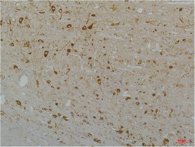 Anti-CACNA1D antibody (1060-1140 aa) (STJ197416) – Figure 1 of 1