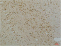 Anti-CACNA1C antibody (STJ197417) – Figure 1 of 1