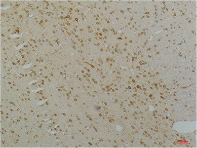 Anti-CACNA1C antibody (STJ197417) – Figure 1 of 1