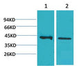 Anti-CALHM1 antibody (204-254 aa) (STJ197420) – Figure 1 of 1