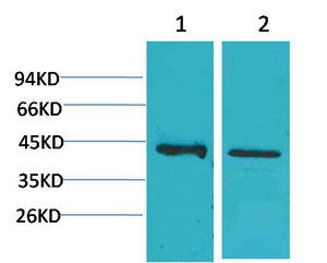 Anti-CALHM1 antibody (204-254 aa) (STJ197420) – Figure 1 of 1