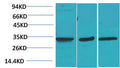 Anti-CACNG3 antibody (84-134 aa) (STJ197421) – Figure 1 of 1