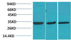 Anti-CACNG3 antibody (84-134 aa) (STJ197421) – Figure 1 of 1