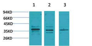 Anti-CACNG2 antibody (58-108 aa) (STJ197422) – Figure 1 of 1