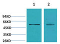 Anti-CACNB3 antibody (STJ197423) – Figure 1 of 1