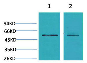 Anti-CACNB3 antibody (STJ197423) – Figure 1 of 1
