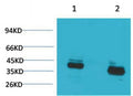Anti-CABP1 antibody (STJ197424) – Figure 1 of 1