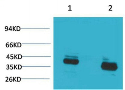 Anti-CABP1 antibody (STJ197424) – Figure 1 of 1