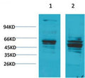 Anti-Bombesin Receptor 2 antibody (STJ197426) – Figure 1 of 1