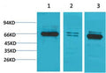 Anti-BEST1 antibody (161-211 aa) (STJ197429) – Figure 1 of 1
