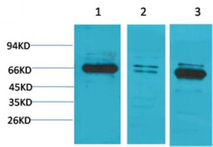 Anti-BEST1 antibody (161-211 aa) (STJ197429) – Figure 1 of 1