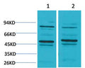 Anti-BEST2 antibody (STJ197430) – Figure 1 of 1