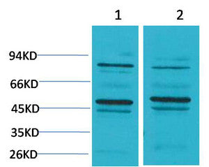 Anti-BEST2 antibody (STJ197430) – Figure 1 of 1