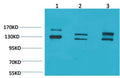 Anti-ADGRB1 antibody (101-151 aa) (STJ197431) – Figure 1 of 1