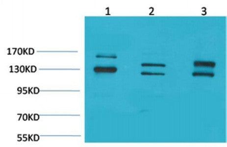 Anti-ADGRB1 antibody (101-151 aa) (STJ197431) – Figure 1 of 1