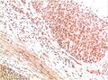 Anti-ATM antibody (STJ197432) – Figure 1 of 1