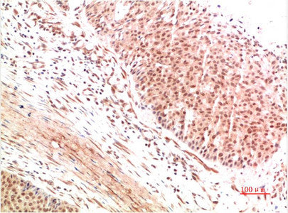 Anti-ATM antibody (STJ197432) – Figure 1 of 1