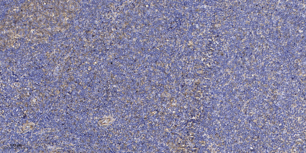 Anti-ATG7 antibody (STJ197433) – Figure 1 of 1
