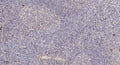 Anti-ATG5 antibody (STJ197434) – Figure 1 of 1