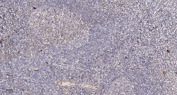 Anti-ATG5 antibody (STJ197434) – Figure 1 of 1