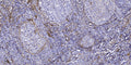 Anti-ATG4C antibody (STJ197435) – Figure 1 of 1