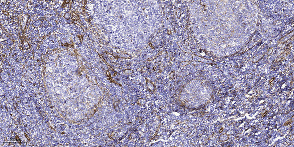 Anti-ATG4C antibody (STJ197435) – Figure 1 of 1