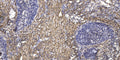 Anti-ATG13 antibody (STJ197439) – Figure 1 of 1