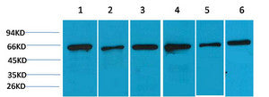 Anti-PRKAA2 antibody (STJ197442) – Figure 1 of 1