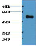 Anti-Alliinase antibody (STJ197444) – Figure 1 of 1