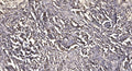 Anti-Cleaved-MMP28-Phe123 antibody (STJ197470) - Figure 1 of 1
