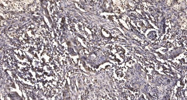 Anti-Cleaved-MMP28-Phe123 antibody (STJ197470) - Figure 1 of 1