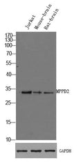 Anti-MPPED2 antibody (143-193 aa) (STJ198144) – Figure 1 of 1
