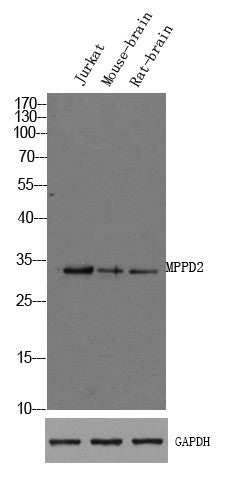 Anti-MPPED2 antibody (143-193 aa) (STJ198144) – Figure 1 of 1